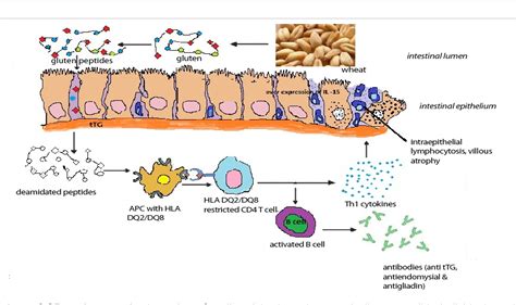 Development Of Celiac Disease Pathogenesis And Strategies To Control A Molecular Approach