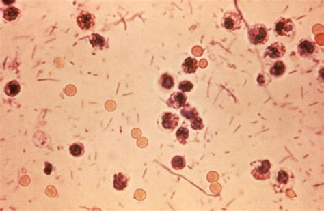 Leukocytes In Stool Fecal Leukocytes Medical Laboratories