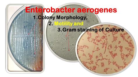 Enterobacter Aerogenes Colony Morphology Motility And Gram Staining Of