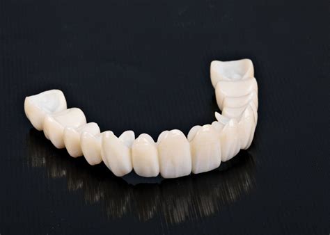 Bezmetalna Keramika Cirkon Dental MatkovicDental Matkovic