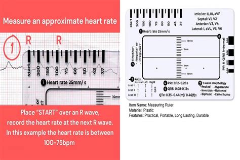 Ts Heart Rate Assessment Tool Axis Deviation Reference Guide Portable