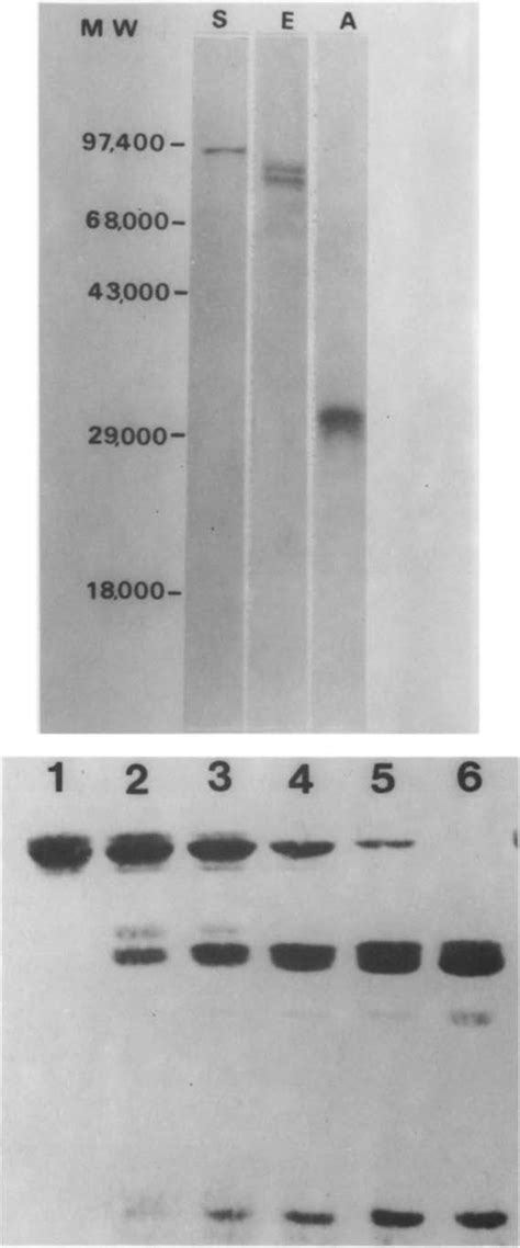 Sds Page Analysis Of The Protein A T Cruzi Antigen No 1 Fusion Download Scientific Diagram