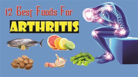 12 Best Foods For Arthritis Good Heath