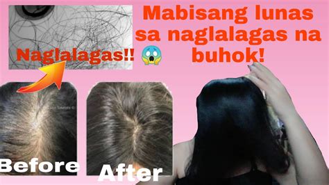 Ano Mabisang Gamot Sa Paglalagas Ng Buhok Medisinagamot