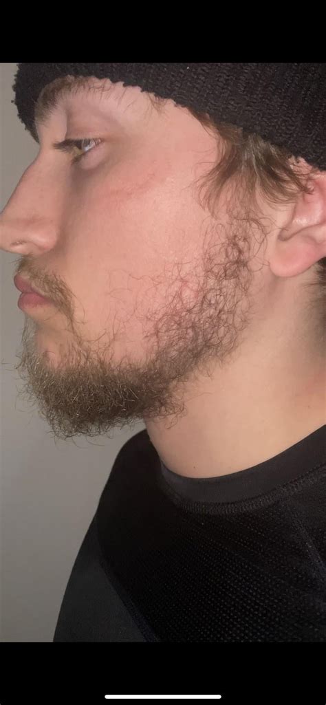 Should I Keep Growing Or Shave 2 Months In R Beardadvice