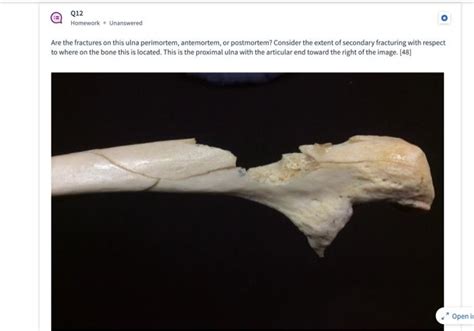 Q12 Homework * Unanswered Are the fractures on this | Chegg.com