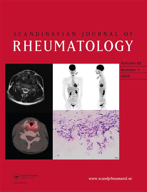 An Assessment Of Grip Strength Measurement In Rheumatoid Arthritis