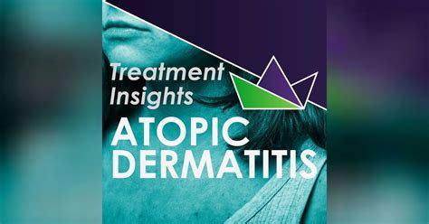 Atopic Dermatitis Treatment Insights Medthority