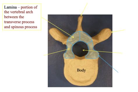 Gross Human Anatomy Lab Osteology Flashcards Quizlet