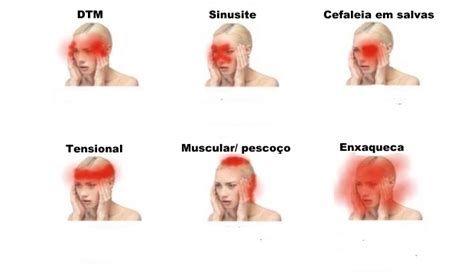 Apenas Reflexões 14 Sinais De Que Suas Dores De Cabeça São Perigosas