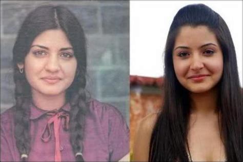 Anushka Sharma Before After