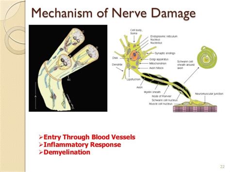 Pathophysiology Of Leprosy