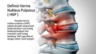 Hernia Nucleus Pulposus Hnp Pptx