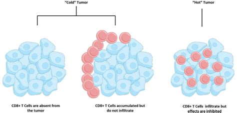 Frontiers Radiotherapy Plus Immune Checkpoint Inhibitor In Prostate