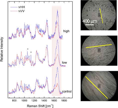 Polarized Raman Spectra From The Controlhealthy As Well As From