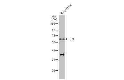 Complement Component C9 Antibody NBP2 15952 Novus Biologicals