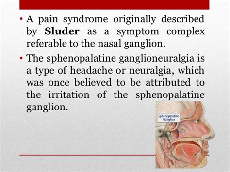 Sphenopalatine Neuralgia