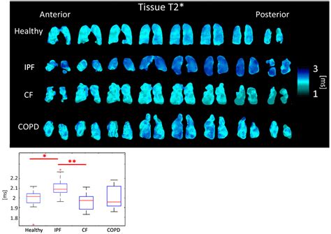 Tomography Free Full Text 3D Single Breath Chemical Shift Imaging