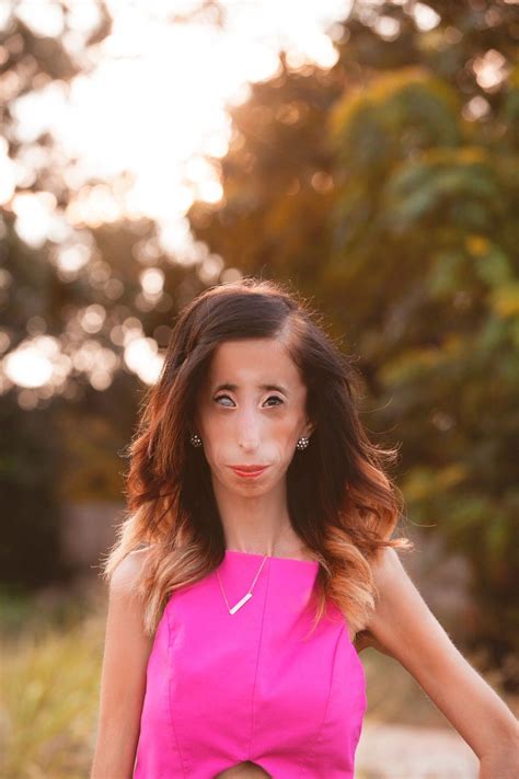 How The Cause Of Anti Bullying Motivated Entrepreneurship The Lizzie Velasquez Story Women