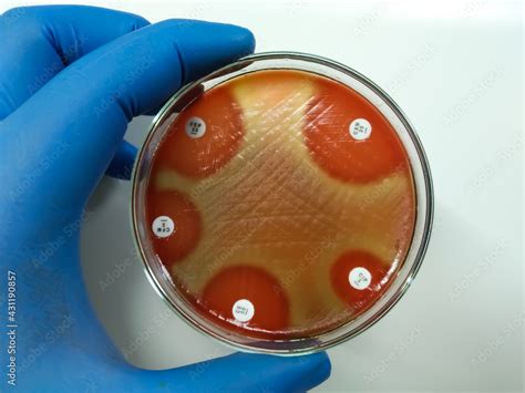 Antimicrobial Susceptibility Testing In Petri Dish Streptococcus