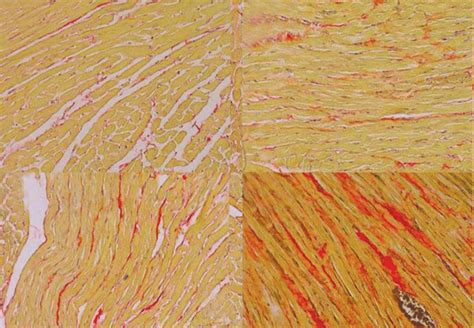 Picrosirius Red Staining For Collagen Fibers In The Rat Myocardium Download Scientific Diagram