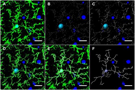 Microglia Modeling Workflow Using Imaris A M Thick Mouse