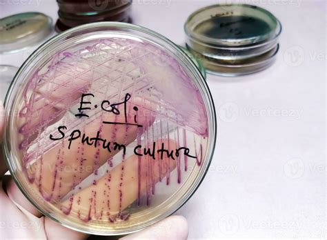 Microbiologist Holding Petri Dish For Sputum Culture Test Showing A