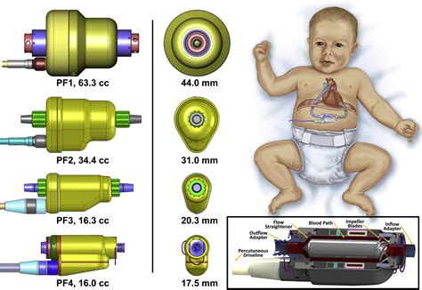 Preclinical Performance Of A Pediatric Mechanical Circulatory Support