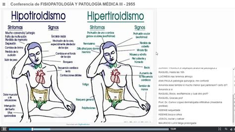 Aula 07 Patologias Tiroideas Parte 02 Dr Joel Youtube