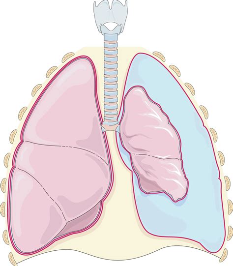 Pneumothorax - Servier Medical Art