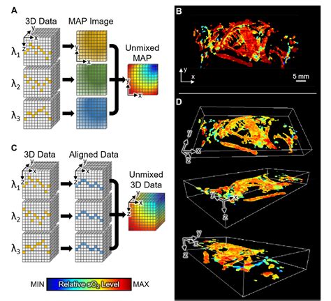 Figure From Ultrasound Guided Breath Compensation In Single Element