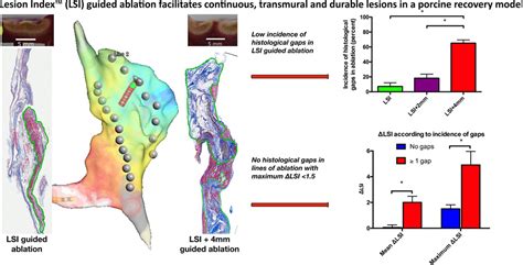 Lesion Indexguided Ablation Facilitates Continuous Transmural And