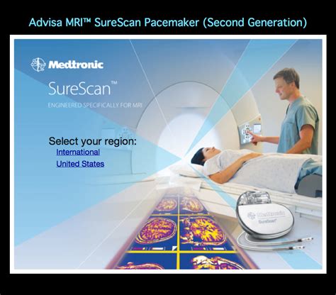 MRI BLOG: Cardiac Pacemaker Designed for MRI Safety