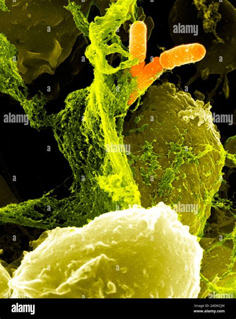 Neutrophils And Shigella Bacteria Coloured Scanning Electron