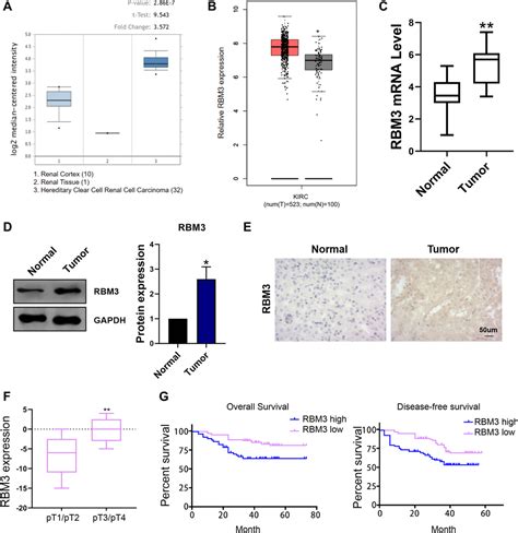 Rbm Promotes Aerobic Glycolysis And Chemoresistance In Renal Clear