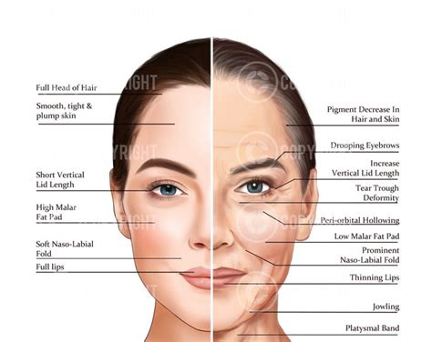 Ageing Of The Face And Neck Botox And Filler Injector Anatomy Esthetician