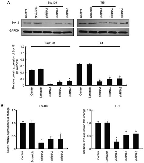 Detection Of Knockdown Efficiency Of Shrna Plasmid A Detection Of