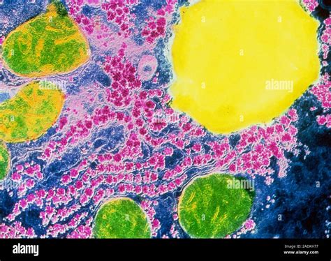 False Colour Transmission Electron Micrograph Tem Of A Section