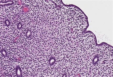 Proliferative Endometrium Histology