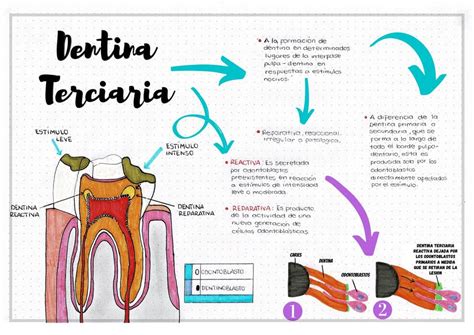 Dentina Terciaria Udocz