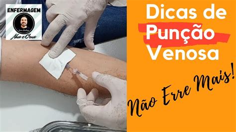 Dicas de Punção venosa na Integra Jelco Abocath YouTube