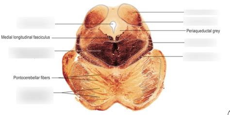 Diagram Of Caudal Medulla Quizlet