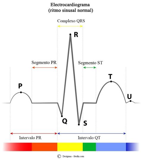 Bloqueio De Ramo Direito E Esquerdo Ecg Divisional E Incompleto