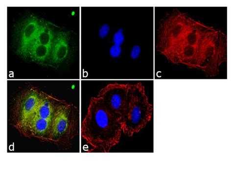 Anti Kras Antibody Mouse Anti Human Monoclonal If Ihc Ip Wb Lsbio