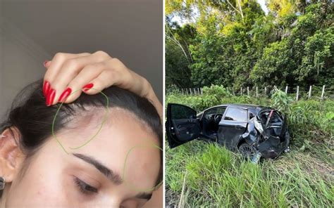 Ex Bbb Gizelly Bicalho Sofre Acidente De Carro No Extremo Sul Da Bahia