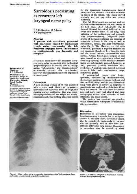 Pdf Sarcoidosis Presenting As Recurrent Left Laryngeal Nerve Palsy