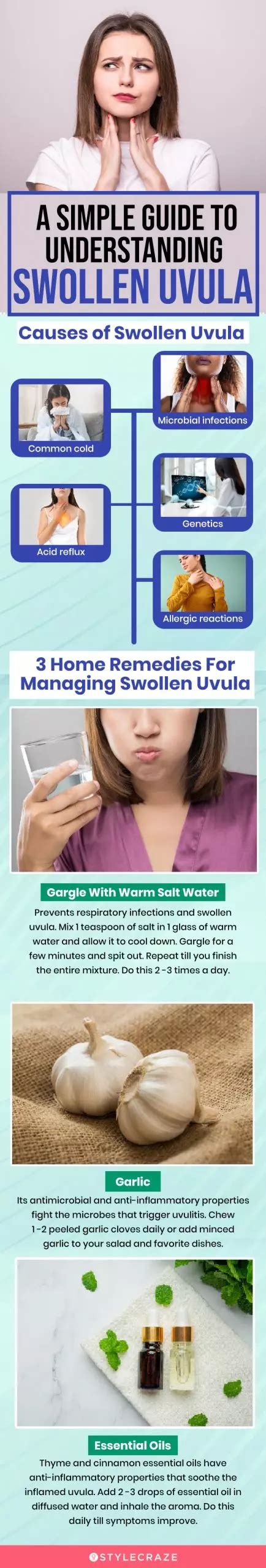 Swollen Uvula Causes Symptoms And 8 Home Remedies To Manage