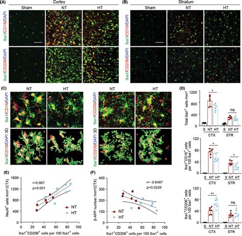 Hypothermia Promotes A Shift Of Microglia Macrophages Towards An