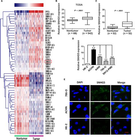 Lncrna Snhg Is Upregulated In Human Ccrcc A Heat Map Showing The