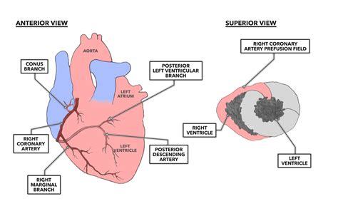 CrossFit | The Heart, Part 7: Coronary Circulation